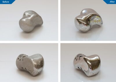 Before and after of metal knee pieces