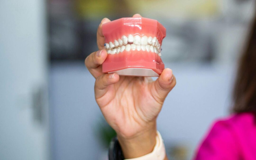 From Print to Polish: Perfecting 3D-Printed Dentures with MFI